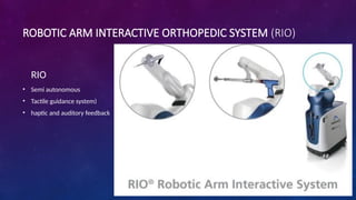 ROBOTIC ARM INTERACTIVE ORTHOPEDIC SYSTEM (RIO)
RIO
• Semi autonomous
• Tactile guidance system)
• haptic and auditory feedback
 