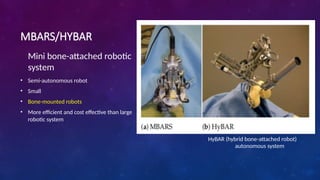 MBARS/HYBAR
Mini bone-attached robotic
system
• Semi-autonomous robot
• Small
• Bone-mounted robots
• More efficient and cost effective than large
robotic system
HyBAR (hybrid bone-attached robot)
autonomous system
 
