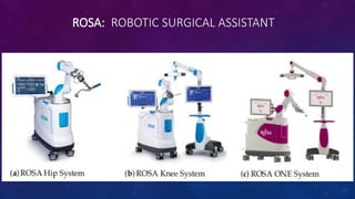 ROSA: ROBOTIC SURGICAL ASSISTANT
 