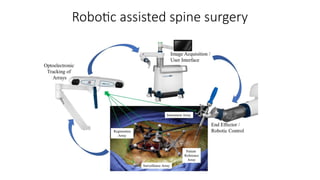 Robotic assisted spine surgery
 