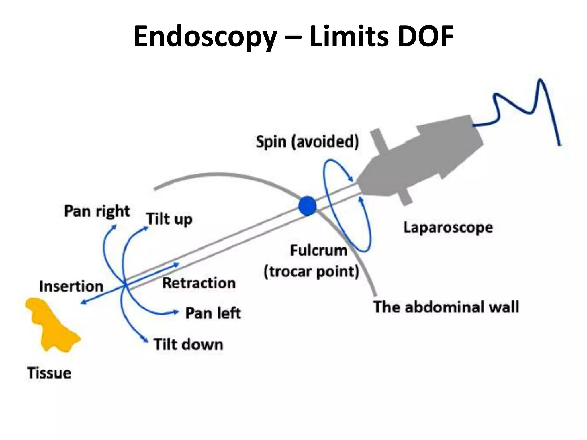 Endoscopy – Limits DOF
 