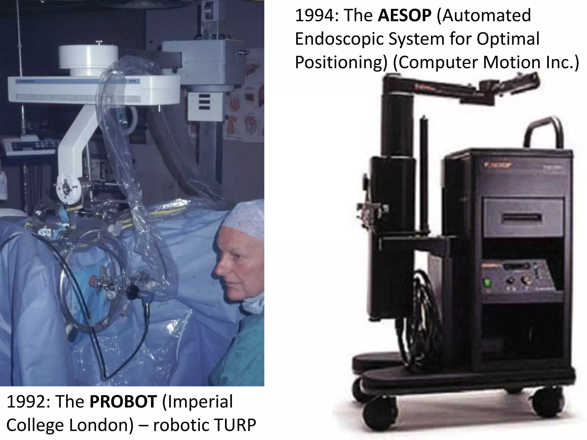 1992: The PROBOT (Imperial
College London) – robotic TURP
1994: The AESOP (Automated
Endoscopic System for Optimal
Positioning) (Computer Motion Inc.)
 