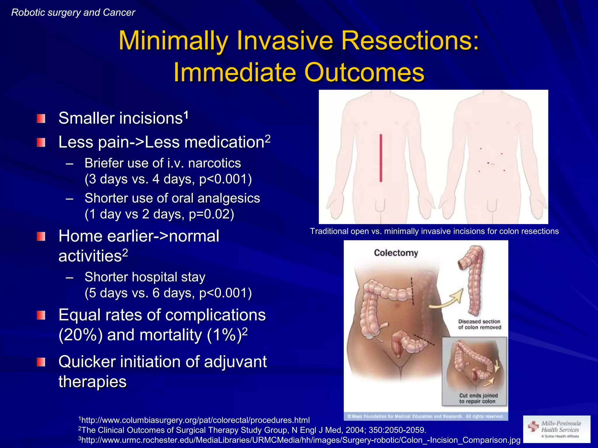 Robotic surgery and cancer gastrointestinal and thoracic | PDF