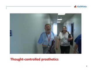 4
Thought‐controlled prosthetics
 