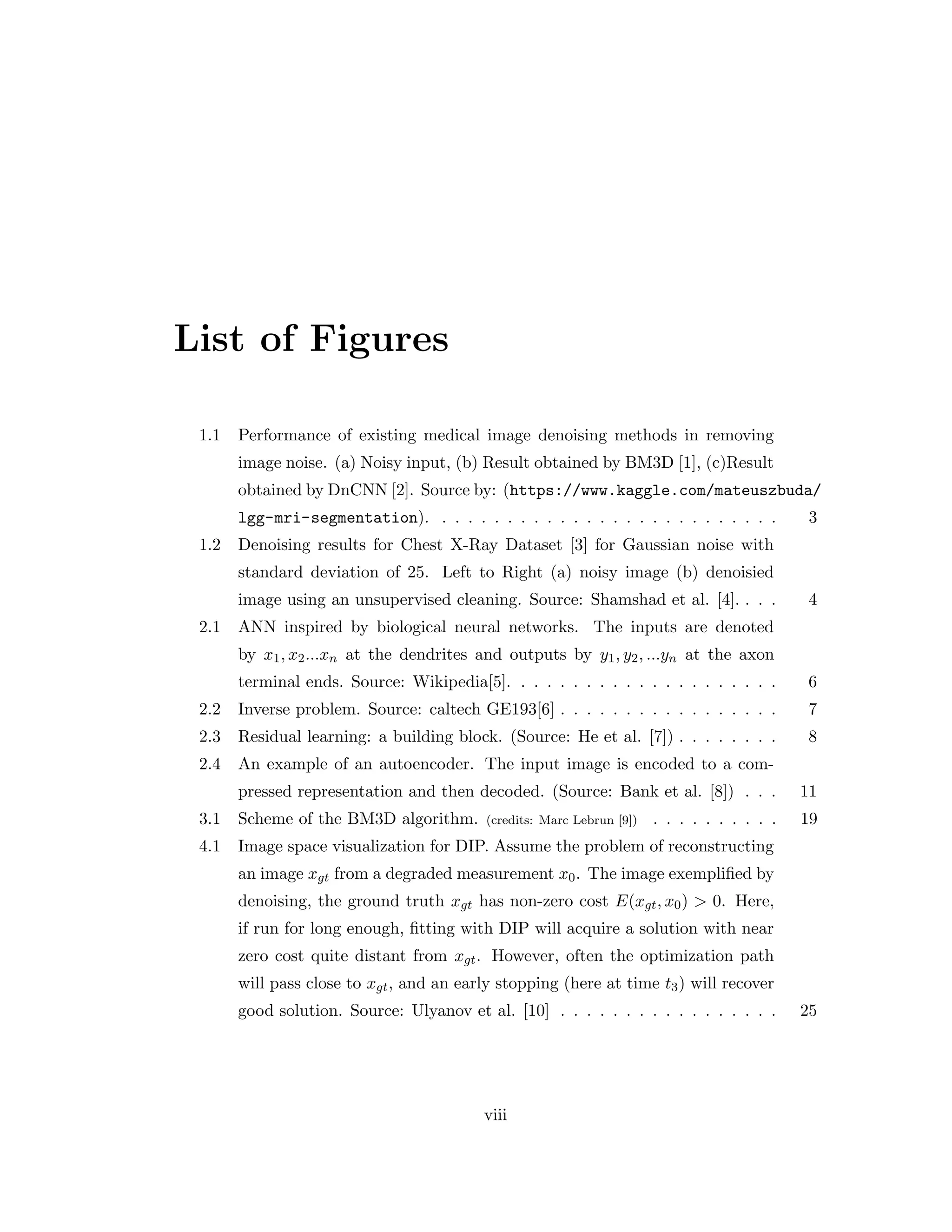 List of Figures 1.1 Performance of existing medical image denoising methods in removing image noise. (a) Noisy input, (b) Result obtained by BM3D [1], (c)Result obtained by DnCNN [2]. Source by: (https://www.kaggle.com/mateuszbuda/ lgg-mri-segmentation). . . . . . . . . . . . . . . . . . . . . . . . . . . 3 1.2 Denoising results for Chest X-Ray Dataset [3] for Gaussian noise with standard deviation of 25. Left to Right (a) noisy image (b) denoisied image using an unsupervised cleaning. Source: Shamshad et al. [4]. . . . 4 2.1 ANN inspired by biological neural networks. The inputs are denoted by x1, x2...xn at the dendrites and outputs by y1, y2, ...yn at the axon terminal ends. Source: Wikipedia[5]. . . . . . . . . . . . . . . . . . . . . 6 2.2 Inverse problem. Source: caltech GE193[6] . . . . . . . . . . . . . . . . . 7 2.3 Residual learning: a building block. (Source: He et al. [7]) . . . . . . . . 8 2.4 An example of an autoencoder. The input image is encoded to a com- pressed representation and then decoded. (Source: Bank et al. [8]) . . . 11 3.1 Scheme of the BM3D algorithm. (credits: Marc Lebrun [9]) . . . . . . . . . . 19 4.1 Image space visualization for DIP. Assume the problem of reconstructing an image xgt from a degraded measurement x0. The image exemplified by denoising, the ground truth xgt has non-zero cost E(xgt, x0) > 0. Here, if run for long enough, fitting with DIP will acquire a solution with near zero cost quite distant from xgt. However, often the optimization path will pass close to xgt, and an early stopping (here at time t3) will recover good solution. Source: Ulyanov et al. [10] . . . . . . . . . . . . . . . . . 25 viii 