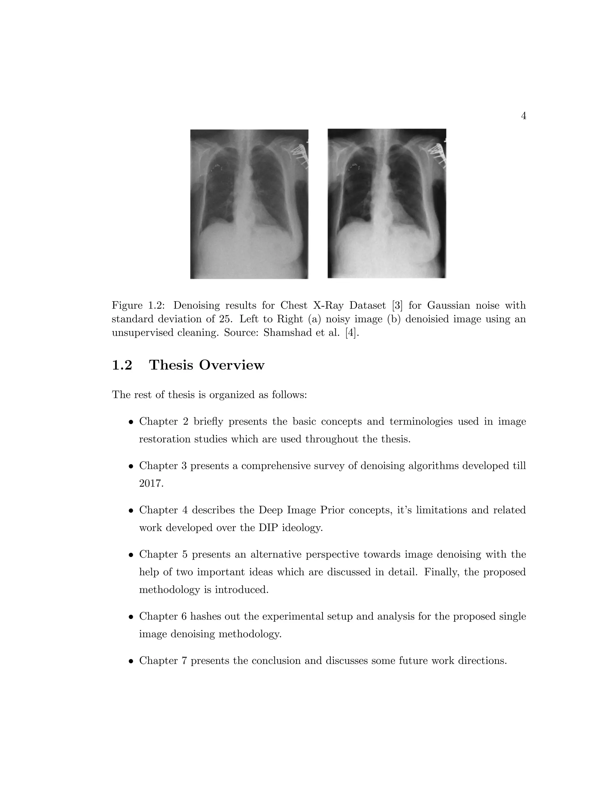 4 Figure 1.2: Denoising results for Chest X-Ray Dataset [3] for Gaussian noise with standard deviation of 25. Left to Right (a) noisy image (b) denoisied image using an unsupervised cleaning. Source: Shamshad et al. [4]. 1.2 Thesis Overview The rest of thesis is organized as follows: • Chapter 2 briefly presents the basic concepts and terminologies used in image restoration studies which are used throughout the thesis. • Chapter 3 presents a comprehensive survey of denoising algorithms developed till 2017. • Chapter 4 describes the Deep Image Prior concepts, it’s limitations and related work developed over the DIP ideology. • Chapter 5 presents an alternative perspective towards image denoising with the help of two important ideas which are discussed in detail. Finally, the proposed methodology is introduced. • Chapter 6 hashes out the experimental setup and analysis for the proposed single image denoising methodology. • Chapter 7 presents the conclusion and discusses some future work directions. 
