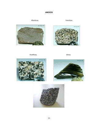 ANEXOS

Afaníticas.

Fanirítica.

Pordíficas.

Vítrea

15

 