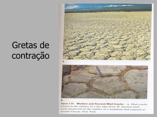 Gretas de
contração
 