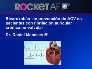 Rivaroxabán en prevención de ACV en
pacientes con fibrilación auricular
crónica no-valvular
Dr. Daniel Meneses M
 
