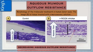 (1)Ren R, Li G, Duong Lr T, Kopczynski C, Stater WD and Gong H.Netarsudil Increases Outflow Facility in Human Eyes Through Multiple Mechanisms . IOVS j November 2016 j Vol. 57 j No. 14 j 6198
 
