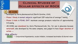 • Developed by Aerie pharmaceutical (North Carolina, USA).
• Phase 1 Study in normal subjects: significant IOP reduction of average 7 mmHg
• Phase 2 trials in POAG, OHT: maximum average pressure reduction of approximately
4.5 mmHg
• AR-12286 was abandoned by Aerie Pharmaceuticals, Inc, for use in glaucoma because
netarsudil, also developed by the same company, was judged to have longer duration of
action. (1) (2)
•Side effects:
• Conjunctival Hyperaemia, ocular irritation, increased lacrimation & blurred vision
(1)Tanna AP and Johnson M.Rho Kinase Inhibitors as a Novel Treatment for Glaucoma and Ocular Hypertension .Ophthalmology Volume 125, Number 11, November 2018
(2)Moshirfar M, Parker L, Birdsong O, Ronquillo Y, Hofstedt D, Shah T, Gomez A and Hoopes P. Use of Rho kinase inhibitors in ophthalmology. A review of literature.Med Hypothesis Discov Innov Ophthalmol. 2018; 7(3)
 