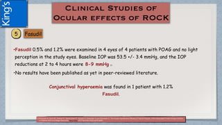 •Fasudil 0.5% and 1.2% were examined in 4 eyes of 4 patients with POAG and no light
perception in the study eyes. Baseline IOP was 53.5 +/- 3.4 mmHg, and the IOP
reductions at 2 to 4 hours were 8-9 mmHg (1)
•No results have been published as yet in peer-reviewed literature.
Conjunctival hyperaemia was found in 1 patient with 1.2%
Fasudil.
(1)Parkavan M, Beni AN, Ghahari E, Varshochian R, Yazdani S, Esfandiari H and Ahmadieh H. The Ocular Hypotensive Efficacy of Topical Fasudil, a Rho-Associated Protein Kinase Inhibitor,
in Patients With End-Stage Glaucoma. Am J Ther. 2017 Nov/Dec;24(6):e676-e680.
 
