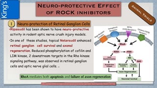 (1)Hu J and Selzer M.RhoA as a target to promote neuronal survival and axon regeneration. Neural Regeneration Research. 2017;12(4):525-528.
•Ripasudil has been shown to have neuro-protective
activity in rodent optic nerve crush injury models.
•In one of these studies, topical Netarsudil enhanced
retinal ganglion cell survival and axonal
regeneration. Reduced phosphorylation of cofilin and
LIM kinase, 2 downstream targets in the Rho kinase
signaling pathway, was observed in retinal ganglion
cells and optic nerve glial cells. (1)
 