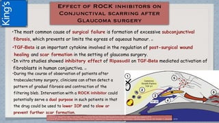 •The most common cause of surgical failure is formation of excessive subconjunctival
fibrosis, which prevents or limits the egress of aqueous humour. (1)
•TGF-Beta is an important cytokine involved in the regulation of post-surgical wound
healing and scar formation in the setting of glaucoma surgery.
•In vitro studies showed inhibitory effect of Ripasudil on TGF-Beta mediated activation of
fibroblasts in human conjunctiva. (2)
•During the course of observation of patients after
trabeculectomy surgery, clinicians can often detect a
pattern of gradual fibrosis and contraction of the
filtering bleb. Intervention with a ROCK inhibitor could
potentially serve a dual purpose in such patients in that
the drug could be used to lower IOP and to slow or
prevent further scar formation.
(1)Schlunk G, Meyet-Ter-Vehn T and Grehn F. Conjunctival fibrosis following filtering glaucoma surgery. Experimental eye research 2016
(2)Tanna AP and Johnson M.Rho Kinase Inhibitors as a Novel Treatment for Glaucoma and Ocular Hypertension .Ophthalmology Volume 125, Number 11, November 2018
 