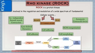 ROCK is a protein kinase
involved in the regulation and modulation of a wide spectrum of fundamental
Cellular events (1)
(1) Moshirfar M, Parker L, Birdsong O, Ronquillo Y, Hofstedt D, Shah T, Gomez A and Hoopes P. Use of Rho kinase inhibitors in ophthalmology. A review of literature.Med Hypothesis Discov Innov Ophthalmol. 2018; 7(3)
 