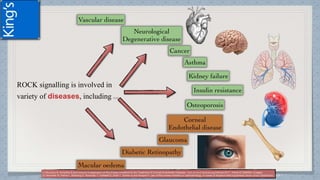 ROCK signalling is involved in
variety of diseases, including (1) (2)
(1)Okumura N, Kinoshita S and Koizumi N.Application of Rho Kinase Inhibitors for the Treatment of Corneal Endothelial Diseases . Hindi Journal of OphthalmologyVolume 2017, Article ID 2646904, 8 pages
(2) Moshirfar M, Parker L, Birdsong O, Ronquillo Y, Hofstedt D, Shah T, Gomez A and Hoopes P. Use of Rho kinase inhibitors in ophthalmology. A review of literature.Med Hypothesis Discov Innov Ophthalmol. 2018; 7
 