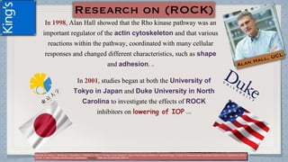 (1)Moshirfar M, Parker L, Birdsong O, Ronquillo Y, Hofstedt D, Shah T, Gomez A and Hoopes P. Use of Rho kinase inhibitors in ophthalmology. A review of literature.Med Hypothesis Discov Innov Ophthalmol. 2018; 7(3)
(2)Hall A. Rho GTPases and the actin cytoskeleton. Science. 1998 Jan 23;279(5350):509-14.
In 2001, studies began at both the University of
Tokyo in Japan and Duke University in North
Carolina to investigate the effects of ROCK
inhibitors on lowering of IOP (1) (2)
In 1998, Alan Hall showed that the Rho kinase pathway was an
important regulator of the actin cytoskeleton and that various
reactions within the pathway, coordinated with many cellular
responses and changed different characteristics, such as shape
and adhesion. (2)
 