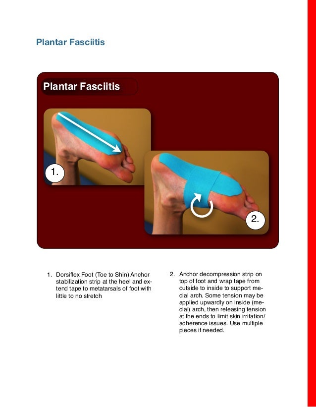 Rock tape powertaping for common injuries