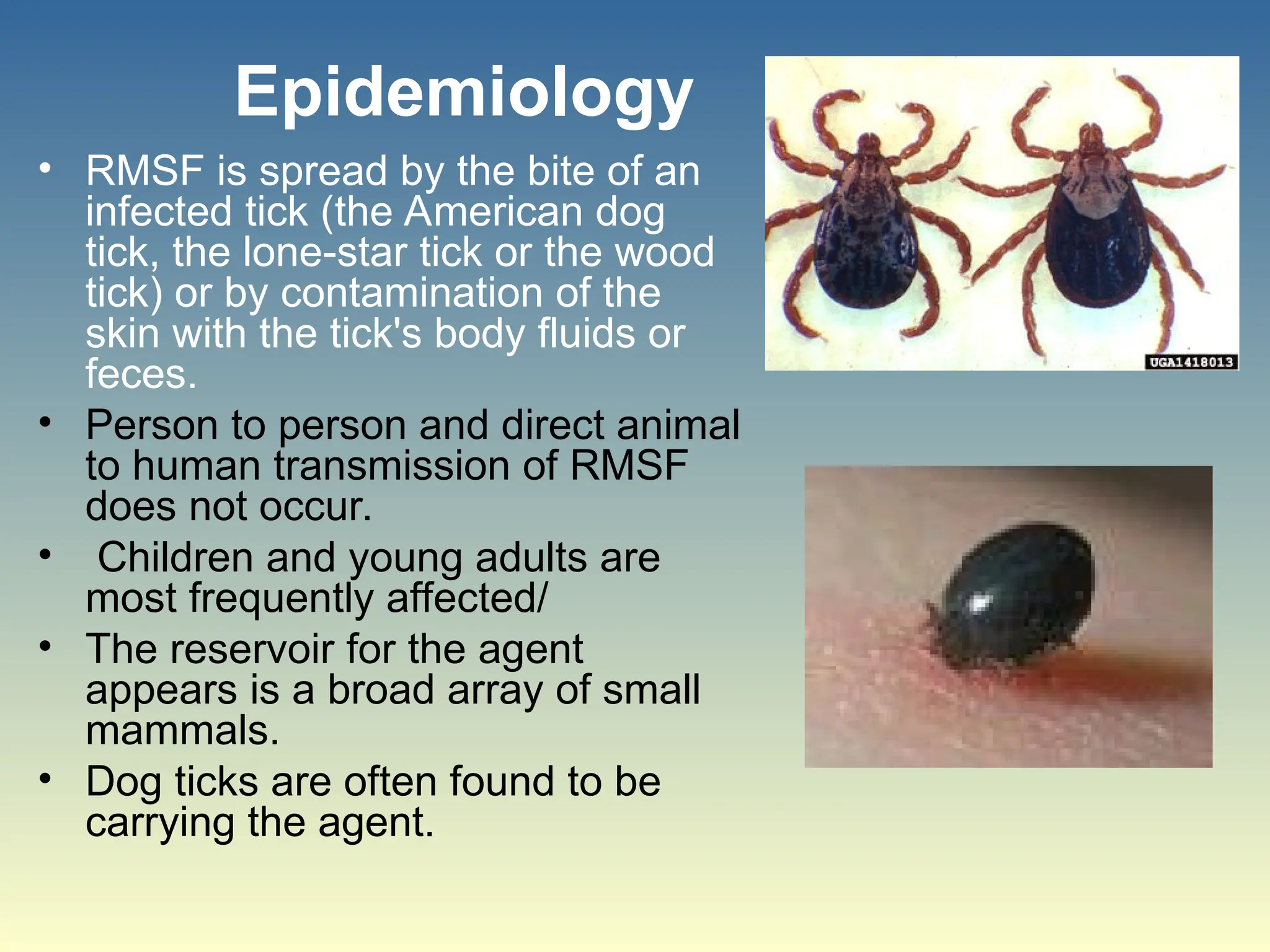 Tick Rmsf Rash Rocky-Mountain-Spotted-Fever2sgsdbdf.ppt