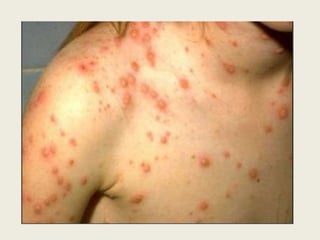 Rodents & disease.pptx