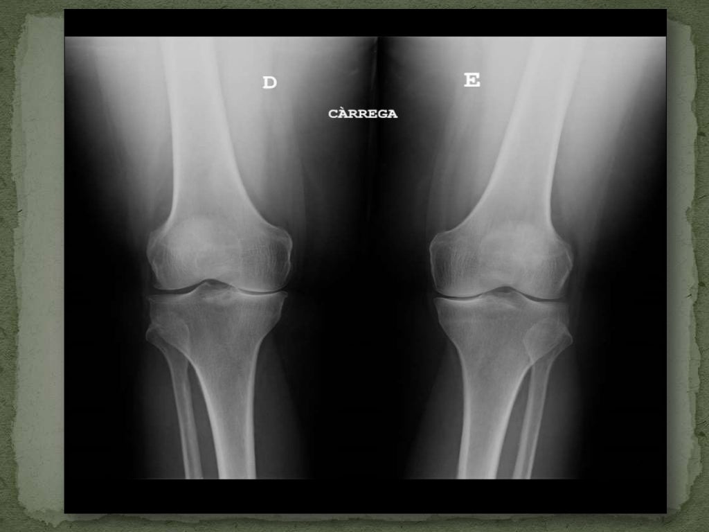 Proyecciones de Rodilla y Tobillo en Radiología Convencional