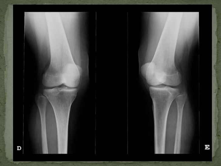 Proyecciones de Rodilla y Tobillo en Radiología Convencional