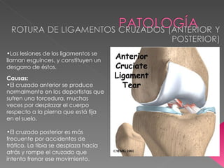 Las lesiones de los ligamentos se llaman esguinces, y constituyen un desgarro de éstos.  Causas: El cruzado anterior se produce normalmente en los deportistas que sufren una torcedura, muchas veces por desplazar el cuerpo respecto a la pierna que está fija en el suelo. El cruzado posterior es más frecuente por accidentes de tráfico. La tibia se desplaza hacia atrás y rompe el cruzado que intenta frenar ese movimiento. 