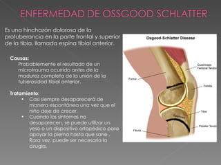Es una hinchazón dolorosa de la protuberancia en la parte frontal y superior de la tibia, llamada espina tibial anterior.  Causas: Probablemente el resultado de un microtrauma ocurrido antes de la madurez completa de la unión de la tuberosidad tibial anterior. Tratamiento: Casi siempre desaparecerá de manera espontánea una vez que el niño deje de crecer. Cuando los síntomas no desaparecen, se puede utilizar un  yeso o un dispositivo ortopédico para apoyar la pierna hasta que sane . Rara vez, puede ser necesaria la cirugía. 