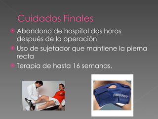 Abandono de hospital dos horas después de la operación Uso de sujetador que mantiene la pierna recta Terapia de hasta 16 semanas. 