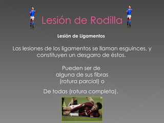 Lesión de Rodilla Lesión de Ligamentos   Las lesiones de los ligamentos se llaman esguinces, y constituyen un desgarro de éstos.  Pueden ser de  alguna de sus fibras  (rotura parcial) o  De todas (rotura completa).   