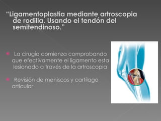 “ Ligamentoplastia mediante artroscopia de rodilla. Usando el tendón del semitendinoso.” La cirugía comienza comprobando  que efectivamente el ligamento esta lesionado a través de la artroscopia Revisión de meniscos y cartílago  articular 