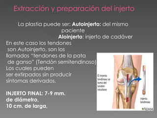 Extracción y preparación del injerto La plastia puede ser:  Autoinjerto:  del mismo paciente Aloinjerto : injerto de cadáver En este caso los tendones son Autoinjerto, son los  llamados “tendones de la pata de ganso” (Tendón semitendinoso). Los cuales pueden  ser extirpados sin producir  síntomas derivados. INJERTO FINAL:  7-9 mm.  de diámetro,  10 cm. de larga,   