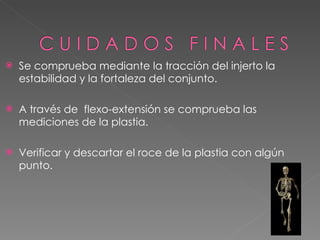 Se comprueba mediante la tracción del injerto la estabilidad y la fortaleza del conjunto.  A través de  flexo-extensión se comprueba las mediciones de la plastia. Verificar y descartar el roce de la plastia con algún punto. 
