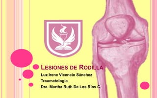 LESIONES DE RODILLA
Luz Irene Vicencio Sánchez
Traumatología
Dra. Martha Ruth De Los Ríos C.

 