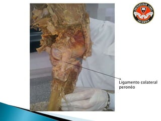 Ligamento colateral
peronéo
 