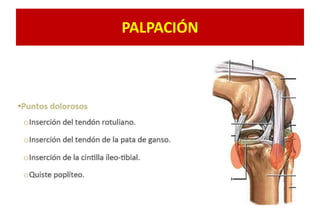 PALPACIÓN
 