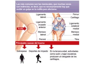 Evaluación de la rodilla