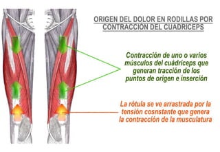 Evaluación de la rodilla