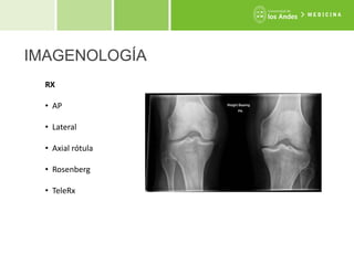 Rotula Axial Rx Meniscos | PPTX
