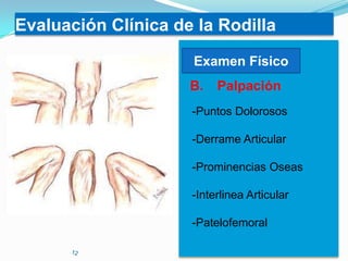Evaluación Clínica de la Rodilla
Examen Físico
B.

Palpación

-Puntos Dolorosos
-Derrame Articular
-Prominencias Oseas
-Interlinea Articular
-Patelofemoral

 