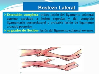 Bostezo Lateral
 Extensión completa- indica lesión del ligamento colateral
externo asociado a lesión capsular y del complejo
ligamentario posterolateral y probable lesión de ligamento
cruzado posterior.
 30 grados de flexión- lesión del ligamento colateral externo.

 