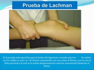 Es la prueba más específica para la lesión del ligamento cruzado anterior.
Se realiza
con la rodilla en unos 20 º de flexión sosteniendo con una mano el fémur y con la otra la
tibia proximal a la cual se la realiza desplazamiento anterior sosteniendo fijamente el
fémur.

 