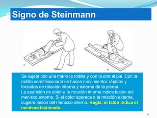 Signo de Steinmann

Se sujeta con una mano la rodilla y con la otra el pie. Con la
rodilla semiflexionada se hacen movimientos rápidos y
forzados de rotación interna y externa de la pierna.
La aparición de dolor a la rotación interna indica lesión del
menisco externo. Si el dolor aparece a la rotación externa,
sugiere lesión del menisco interno. Regla: el talón indica el
menisco lesionado.
25

 
