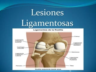 Lesiones
Ligamentosas

 