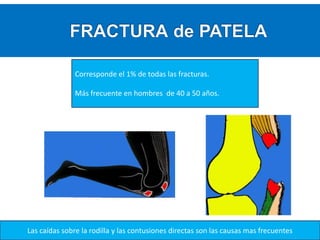 Corresponde el 1% de todas las fracturas.
Más frecuente en hombres de 40 a 50 años.

Las caídas sobre la rodilla y las contusiones directas son las causas mas frecuentes

 