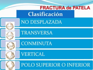 Clasificación
NO DESPLAZADA
TRANSVERSA
CONMINUTA
VERTICAL
POLO SUPERIOR O INFERIOR

 