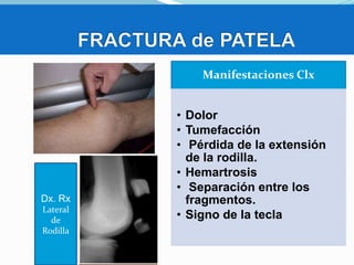 Manifestaciones Clx

Dx. Rx
Lateral
de
Rodilla

• Dolor
• Tumefacción
• Pérdida de la extensión
de la rodilla.
• Hemartrosis
• Separación entre los
fragmentos.
• Signo de la tecla

 