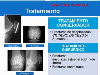 TRATAMIENTO
CONSERVADOR
• Fracturas no desplazadas:
CILINDRO DE YESO (4
Semanas)
Osteosíntesis

Cerclaje

TRATAMIENTO
QUIRÚRGICO
• Fracturas
desplazadas(separacion >de
4mm)
• Fracturas conminutas.

Obenque

 