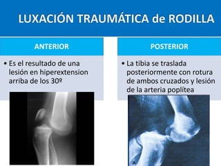 ANTERIOR
• Es el resultado de una
lesión en hiperextension
arriba de los 30º

POSTERIOR
• La tibia se traslada
posteriormente con rotura
de ambos cruzados y lesión
de la arteria poplítea

 