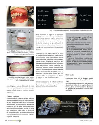 Rodillos | PDF